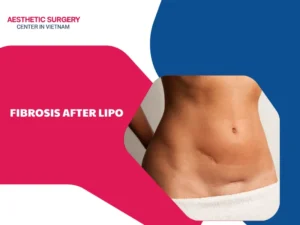 fibrosis afterlipo