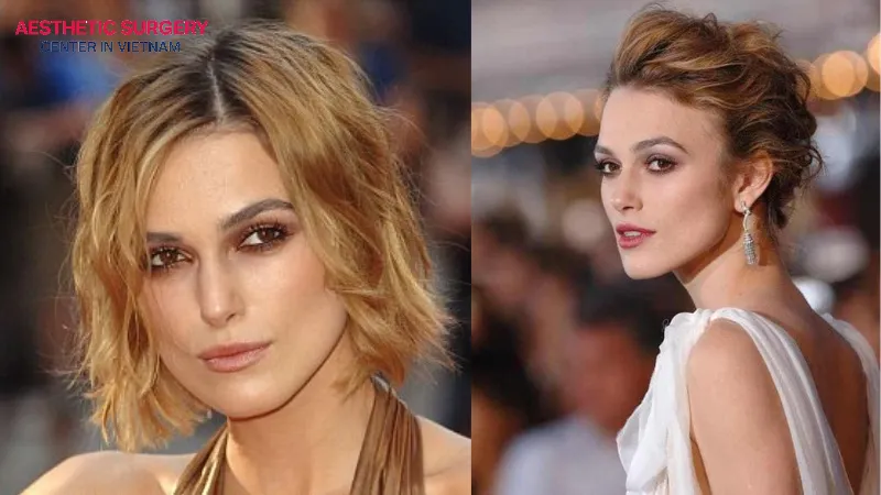 Keira Knightley also opted for a hair transplant to restore her naturally thick and healthy hair.