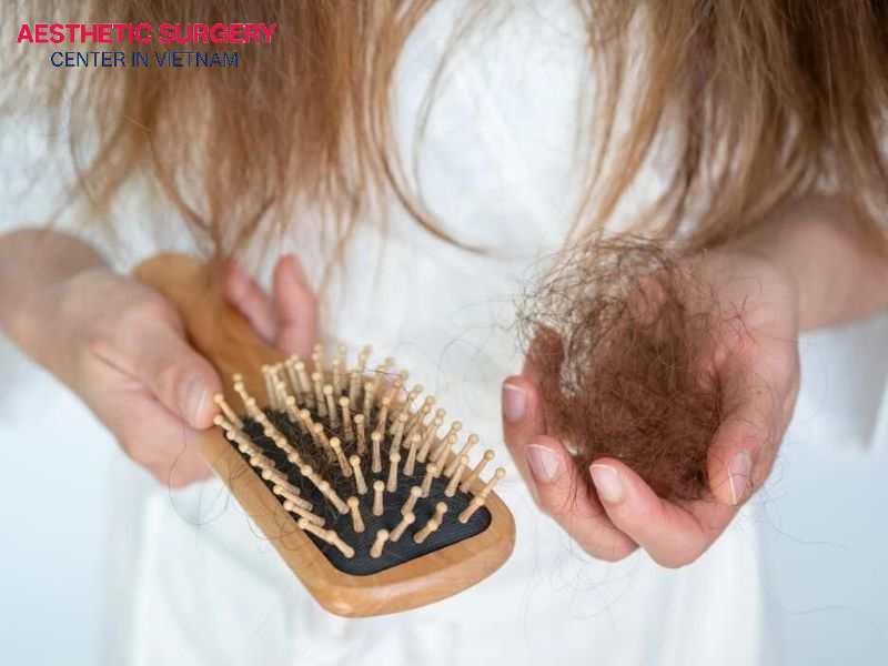 Hair shedding after a transplant is a condition that most patients will experience.