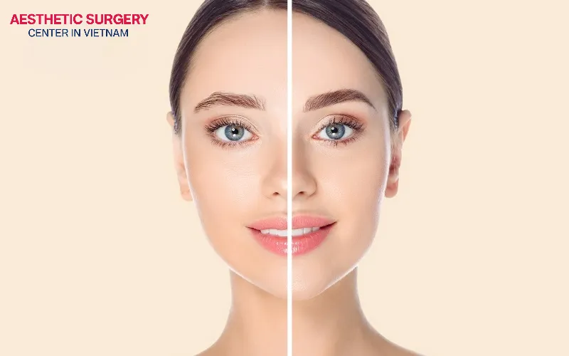 A brow lift helps the face look fresher and more youthful.