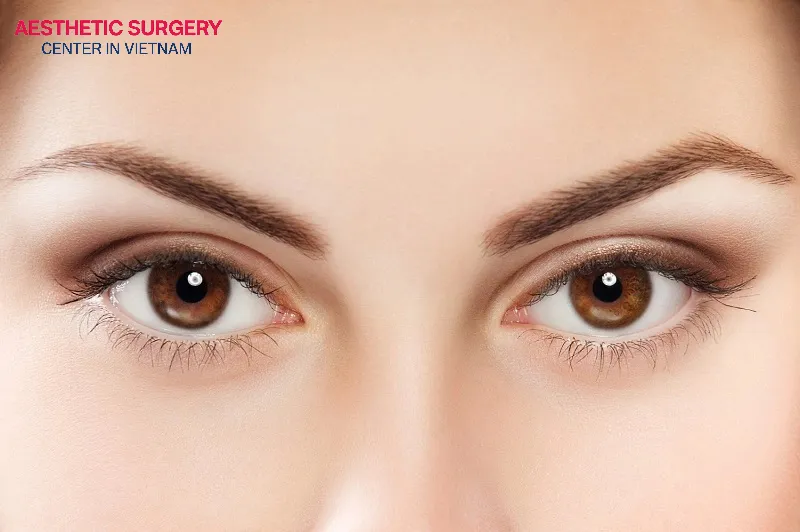 A brow lift helps enhance the eye area, making it appear more youthful and attractive.