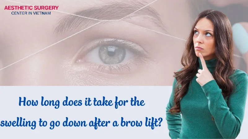 Typically, swelling after a brow lift will gradually subside within 1–2 weeks.
