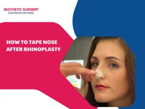 how to tape nose after Rhinoplasty