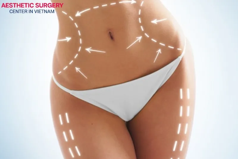 Non-surgical fat reduction helps the body look slimmer and more toned.