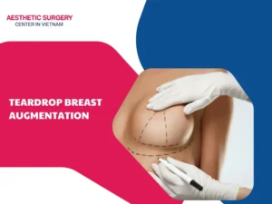 teardrop breast augmentation