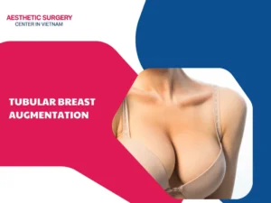 What is tubular breast augmentation? Procedure and suitable candidates