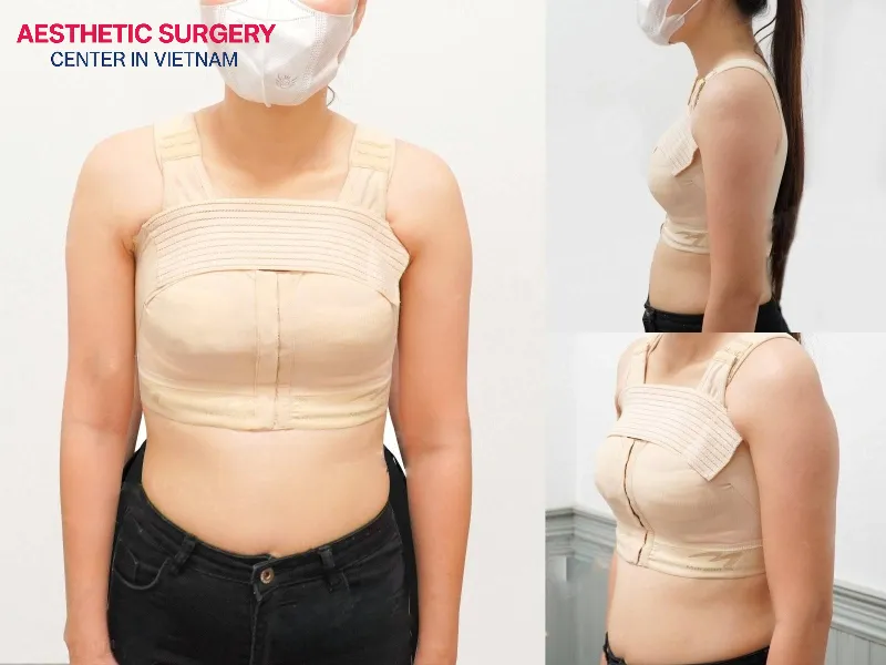 You need to choose a suitable medical bra for support after Breast Augmentation.