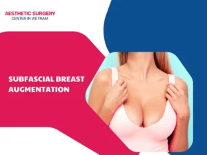 Subfascial Breast Augmentation – A Safe Method for Naturally Soft Breast Contours