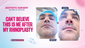 CLIP KH HAMED REVIEW NANG MUI