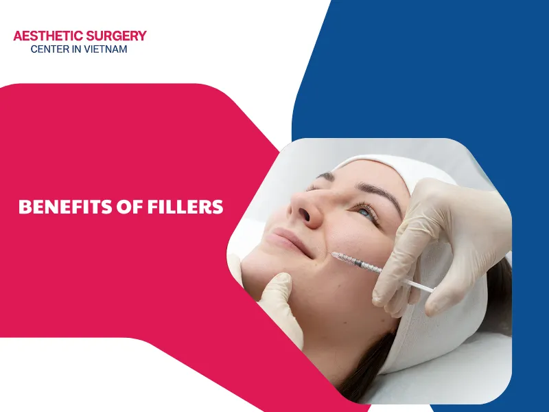 9 lesser - Known benefits of fillers in facial rejuvenation