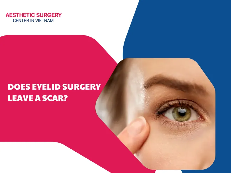 Does eyelid surgery leave a scar? Factors that cause scarring
