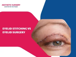 Eyelid stitching vs eyelid surgery