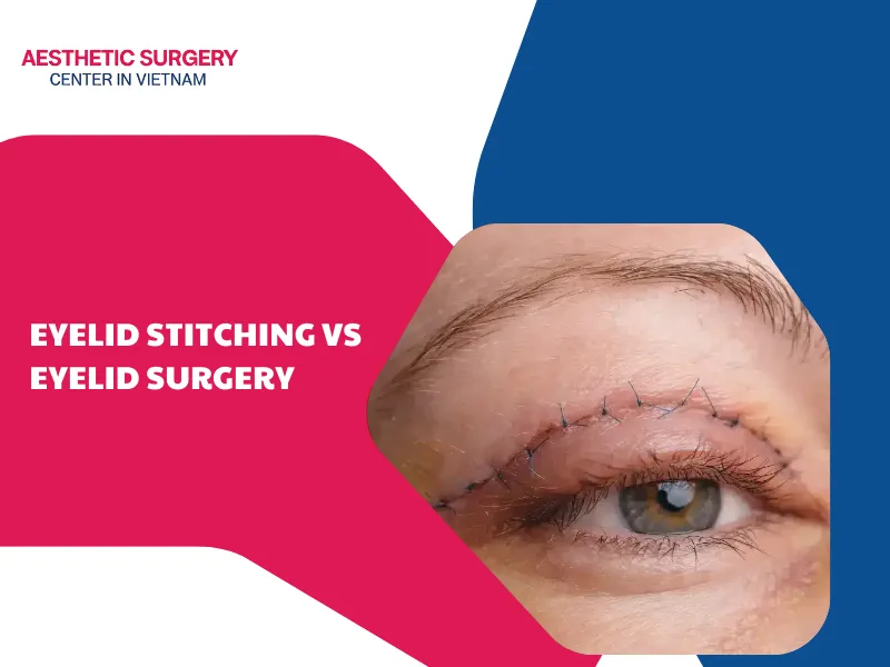 Eyelid stitching vs eyelid surgery