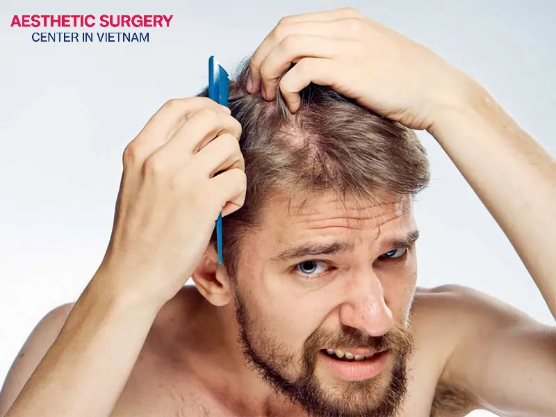 Sparse and uneven hair growth is a key sign of a failed hair transplant.