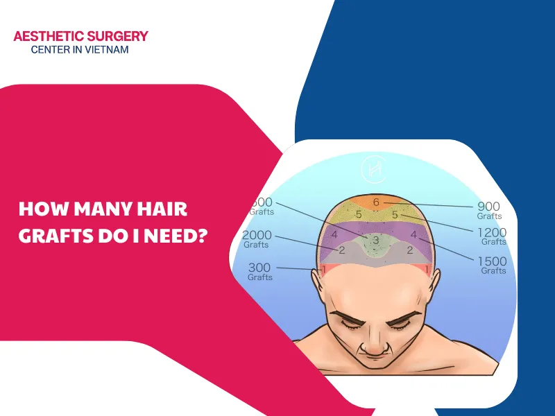 How many hair grafts do I need?
