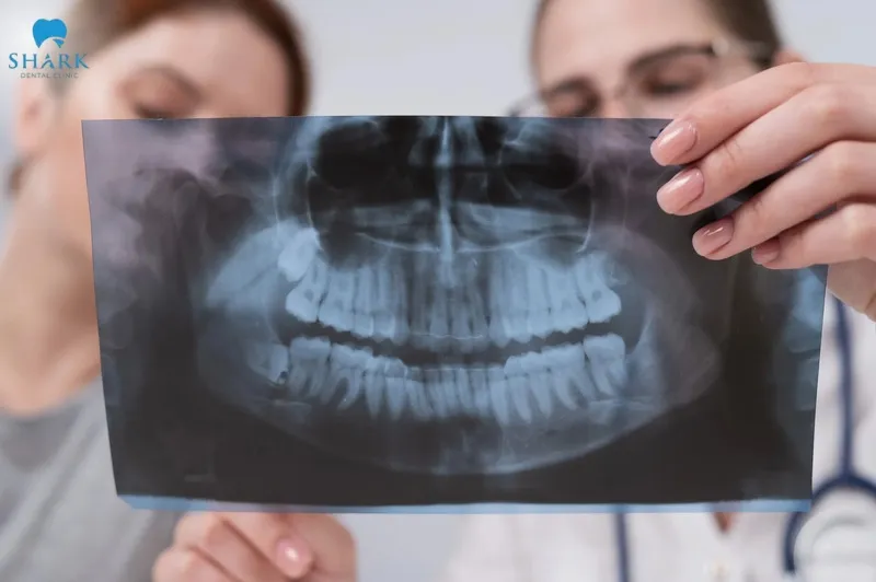 Dental X-ray imaging works on the principle that X-rays pass through oral tissues and record images onto film or digital sensors