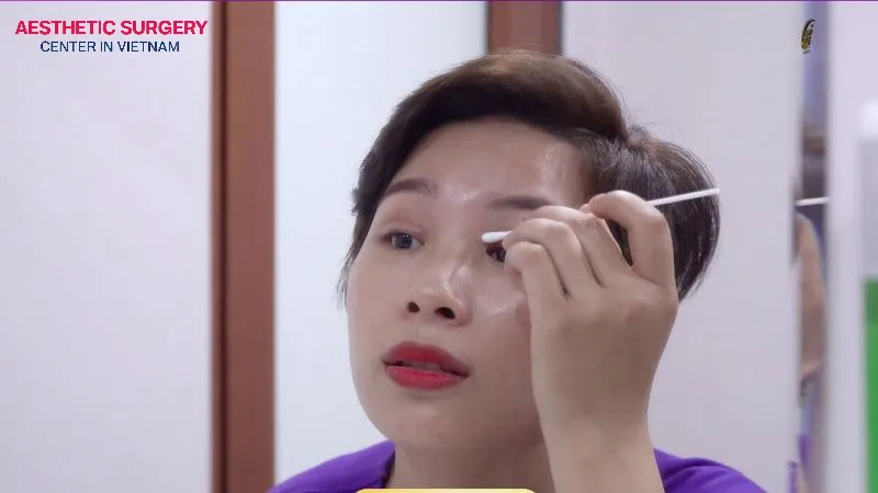 To prevent scarring after eyelid surgery, you need to take careful care of the incision.