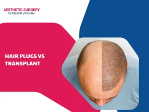 Hair plugs vs transplant – Detailed comparison