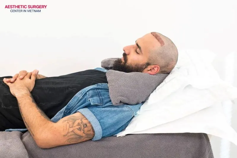 The correct sleeping position after a hair transplant helps the hair follicles survive well and limits excessive friction on the transplanted area during the first days.