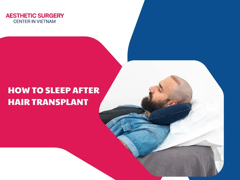 how to sleep after hair transplant