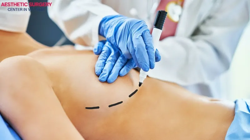 To undergo a second breast augmentation, you should wait at least 6–12 months after the first procedure to avoid affecting your health.