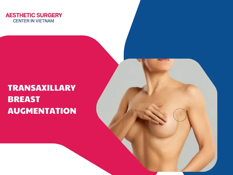 What is transaxillary breast augmentation? Standard procedure