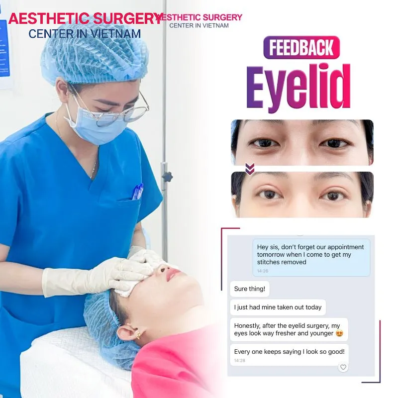 Patient reviews after eyelid stitching at Aesthetic Surgery Vietnam
