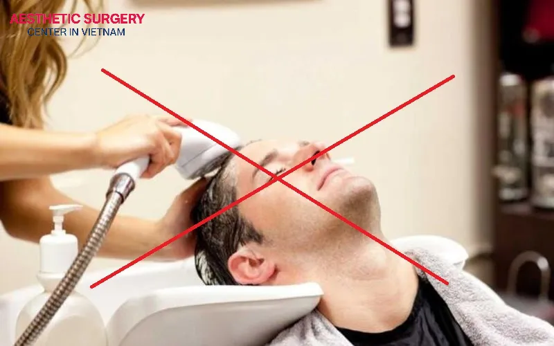You should not wash your hair during the first 24–48 hours after a hair transplant.