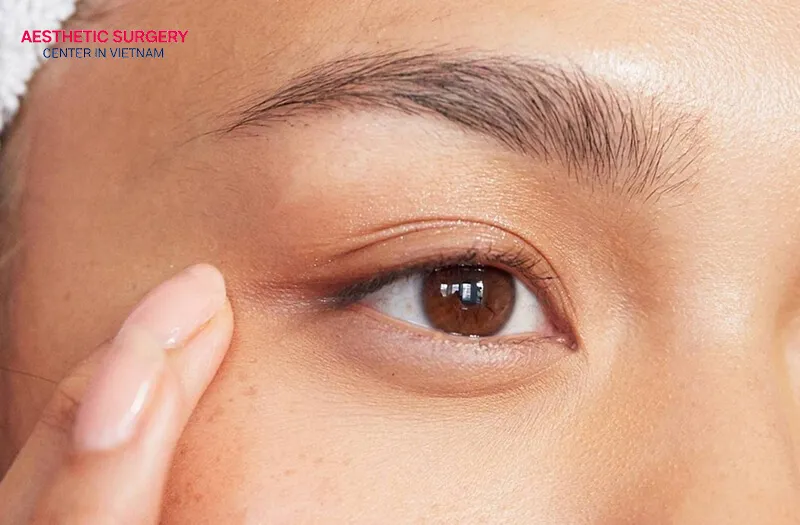Eyelid drooping is a common but harmless side effect.