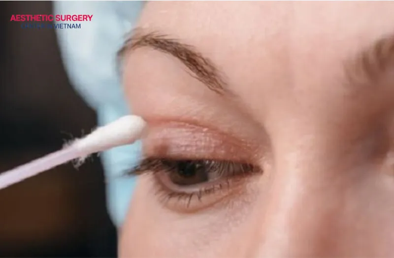 Neosporin is suitable for use on sensitive skin areas such as the eyelids.