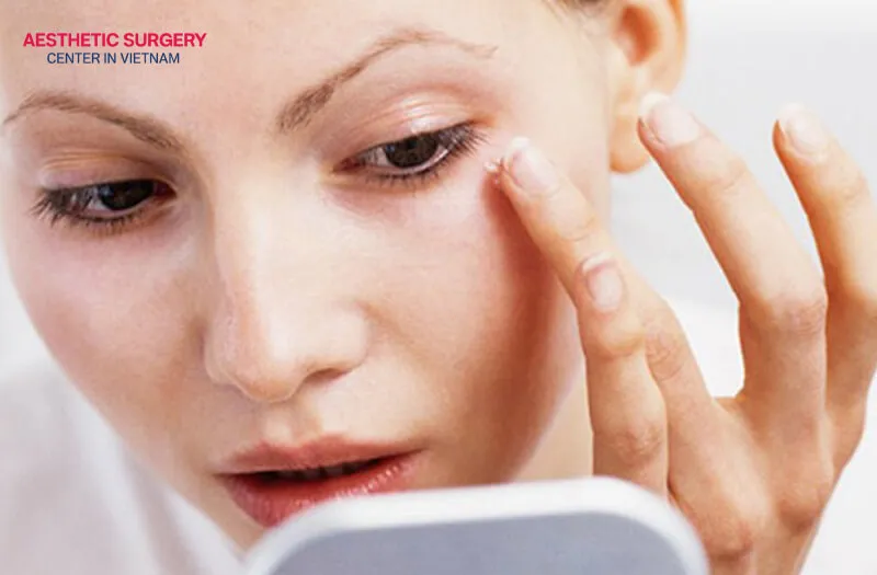 It is important to apply the medication using proper technique to ensure effective treatment of eye-area injuries.