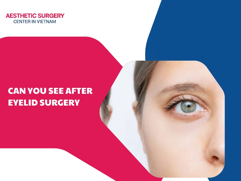 Can you see after eyelid surgery? Care after eyelid surgery