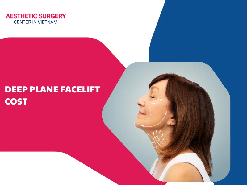 deep plane facelift cost