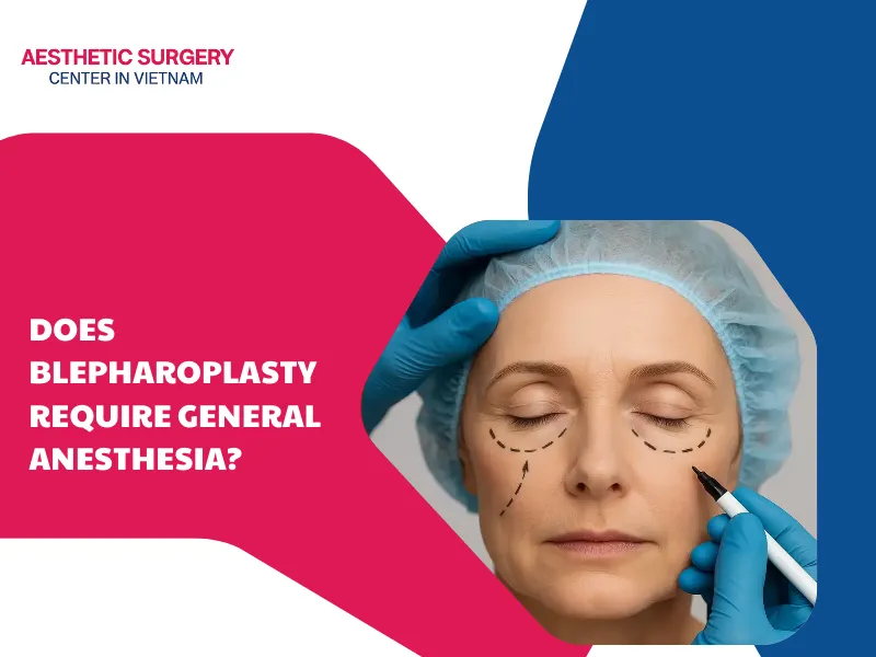 does blepharoplasty require general anesthesia