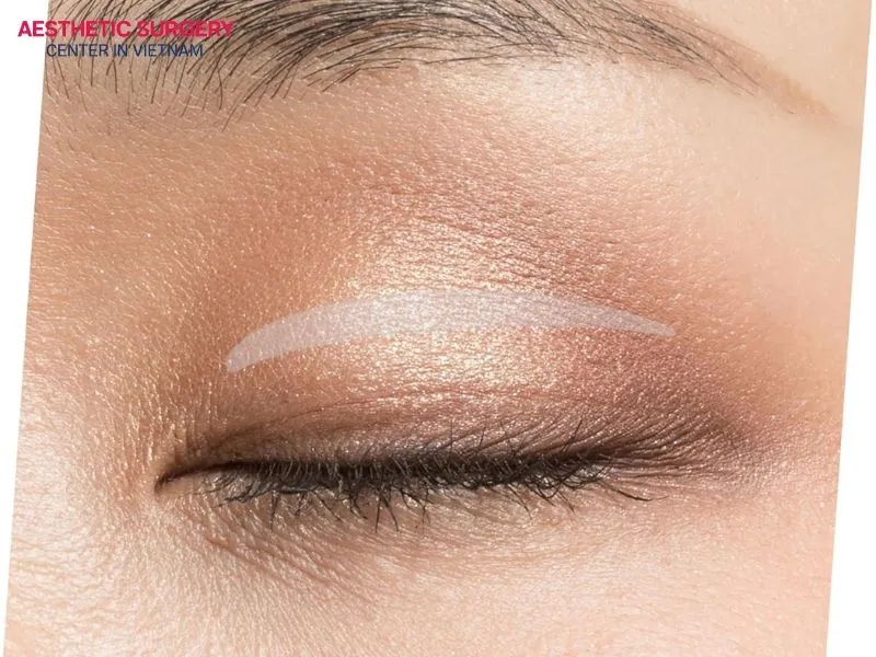 Eyelid tape usually comes in transparent white or beige, making it blend easily with the skin and very hard to notice.