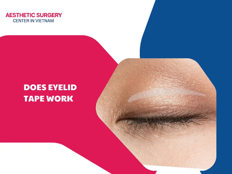 Does eyelid tape work? Things to know before choosing