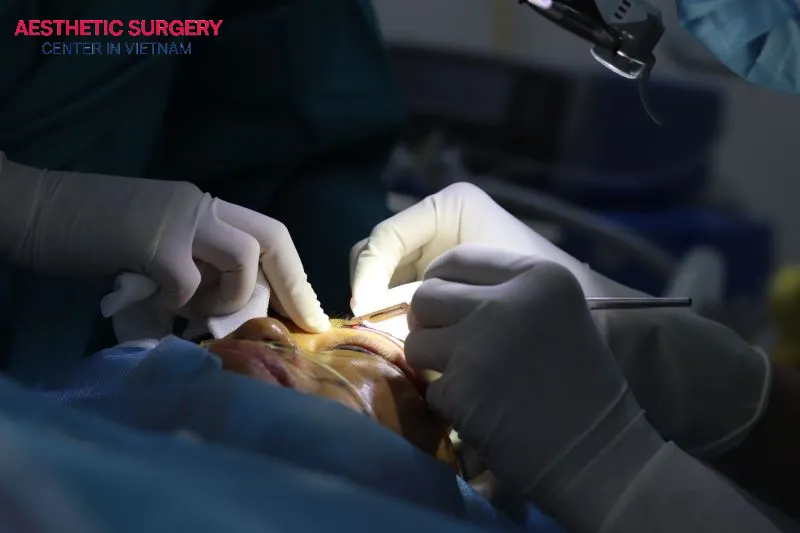 Eyelid surgery helps remove excess skin and rejuvenate the skin around the eyes.