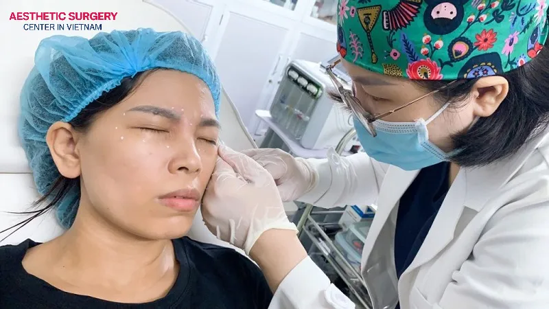 Choose a reputable clinic with skilled, experienced aesthetic doctors to perform botox injections.