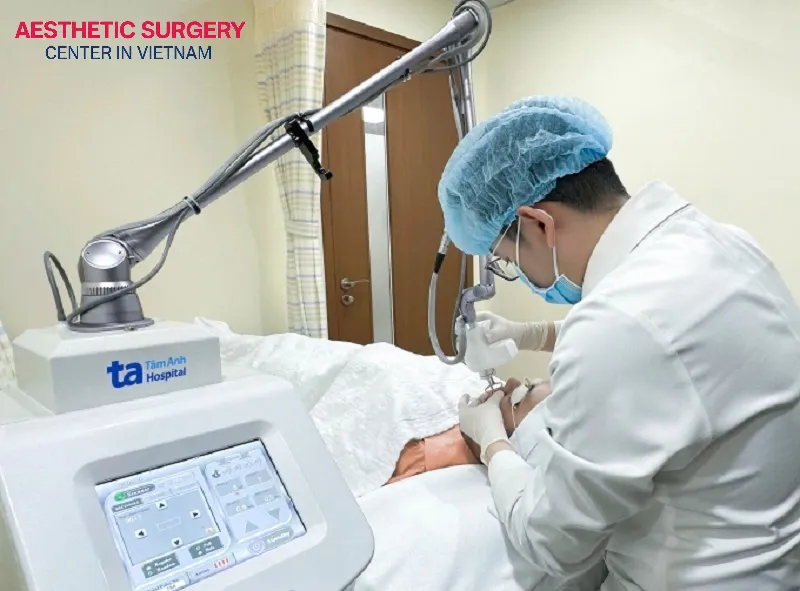 Laser treatment helps break down scar tissue and stimulates new collagen and elastin production to regenerate the skin surface.