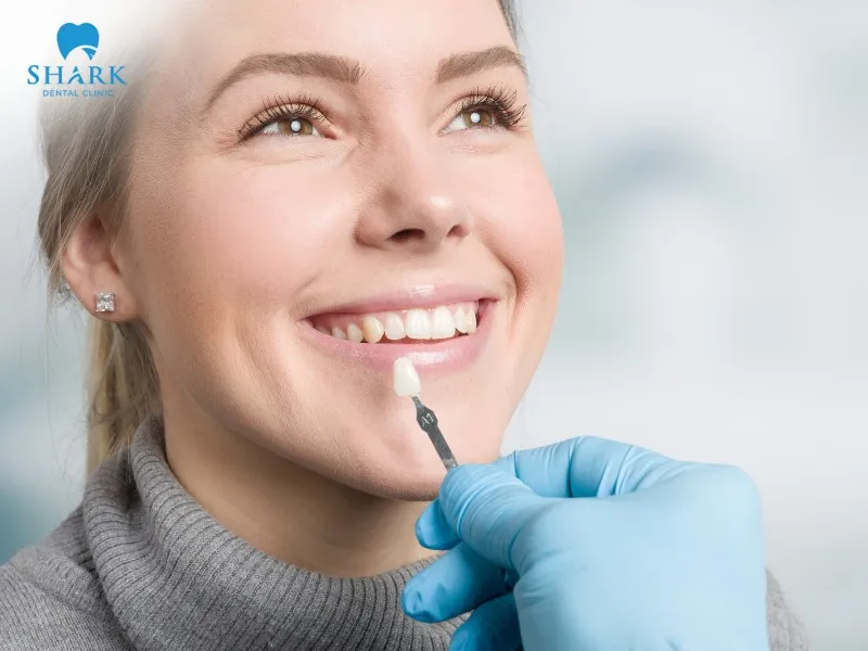 Dental veneers improve tooth color issues such as yellowing, discoloration, and dark gum lines