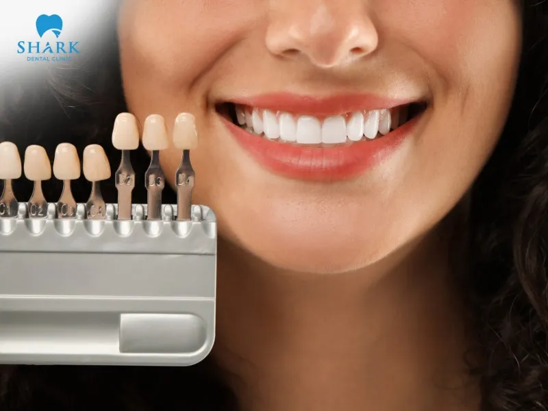 Dental veneers effectively correct spaced teeth and noticeable gaps