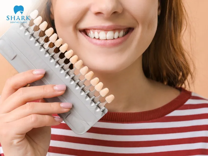 Porcelain veneers help improve dental imperfections such as yellowed, discolored, and aesthetically compromised teeth