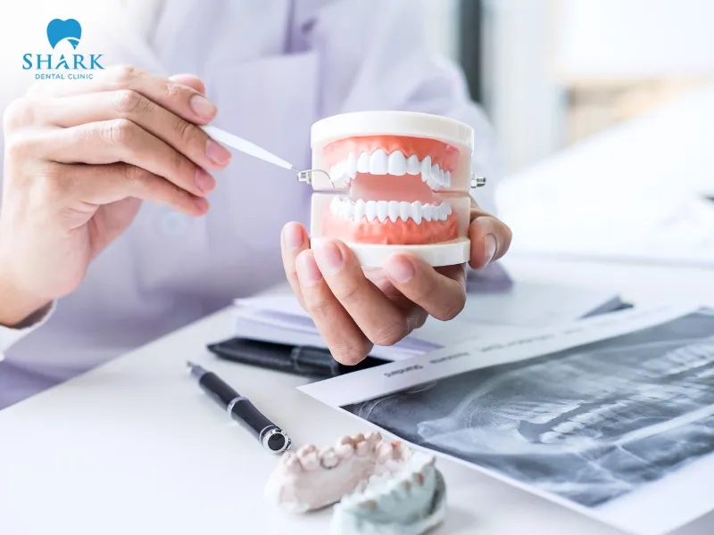 Porcelain veneers are not suitable for all patients