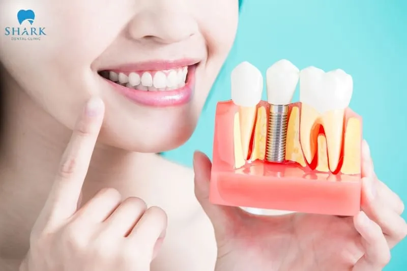 Dental implant placement is a restorative method that many experts consider to deliver the highest effectiveness currently available