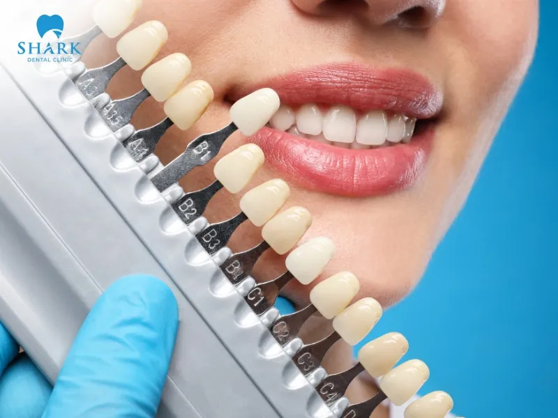 Translucency: E.max porcelain offers superior translucency compared to Zirconia, providing better aesthetic value and receiving high patient satisfaction