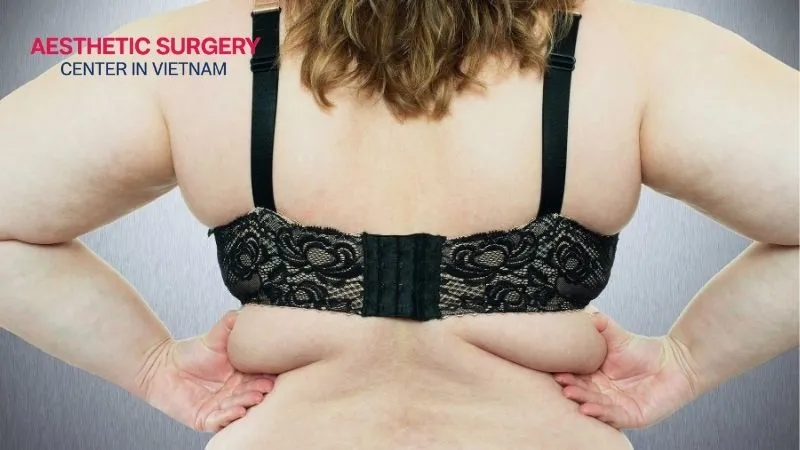 Back fat can develop due to genetics, hormonal changes, or a sedentary lifestyle.