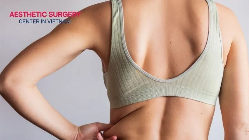 You need good overall health and good skin elasticity to be suitable for back fat liposuction.