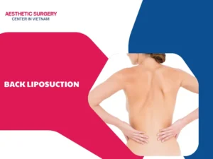 What is back liposuction? Cost, procedure, and benefits
