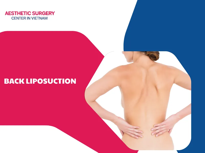 What is back liposuction? Cost, procedure, and benefits