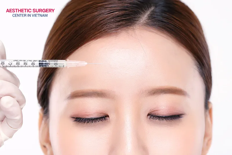 The cost of botox for forehead lines is not too high compared to many other treatments.